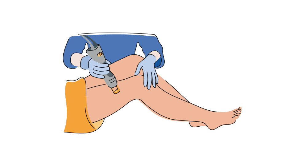 Laser Hair Removal Illustration